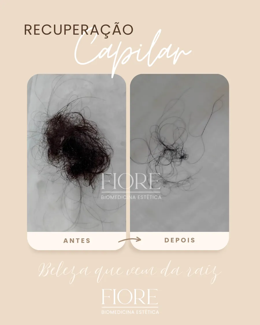 Antes e depois de recuperação capilar na Fiore
